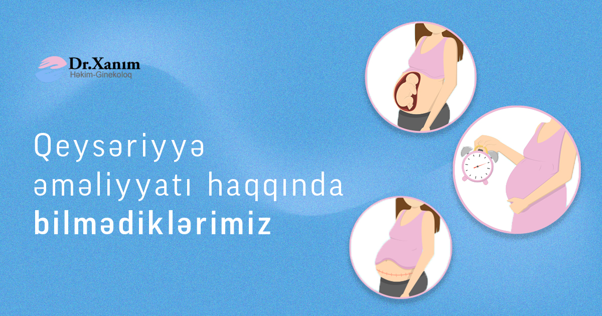 Qeysəriyyə əməliyyatı haqqında bilmədiklərimiz - Drxanim.az