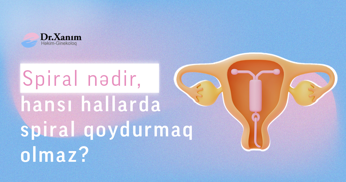 Spiral nədir? Hansı hallarda spiral qoydurmaq olmaz? - Drxanim.az