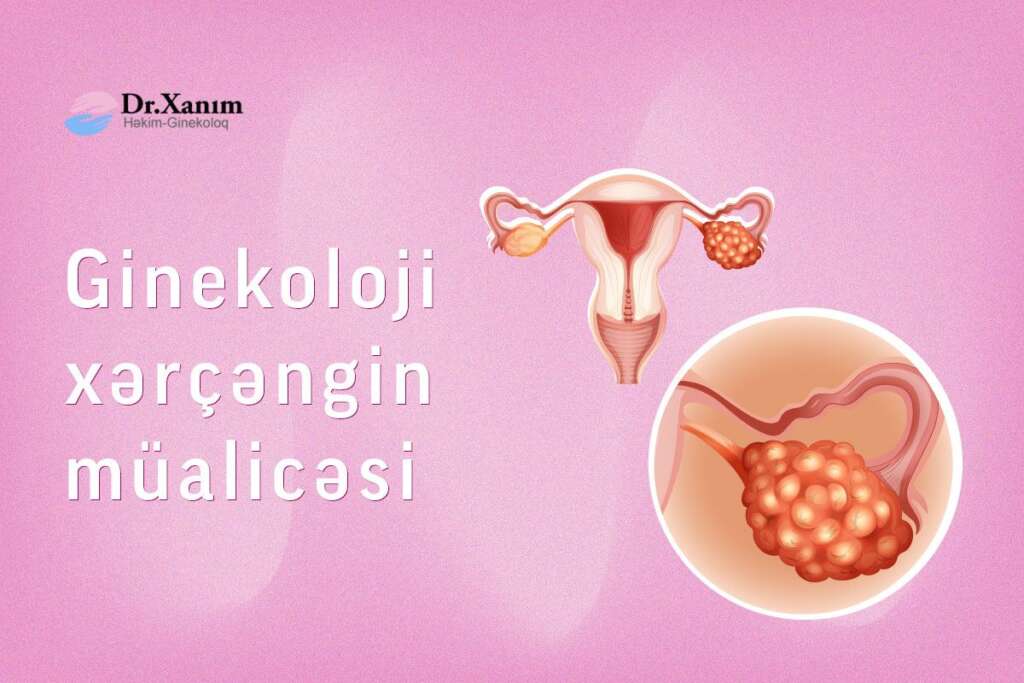 Xanım Adıgözəlova