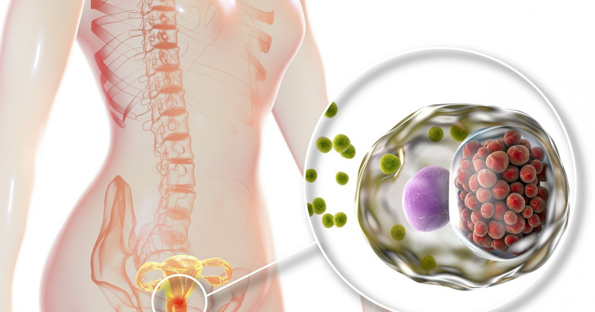 Cinsi yolla keçən infeksiyalar, növləri və simptomları
