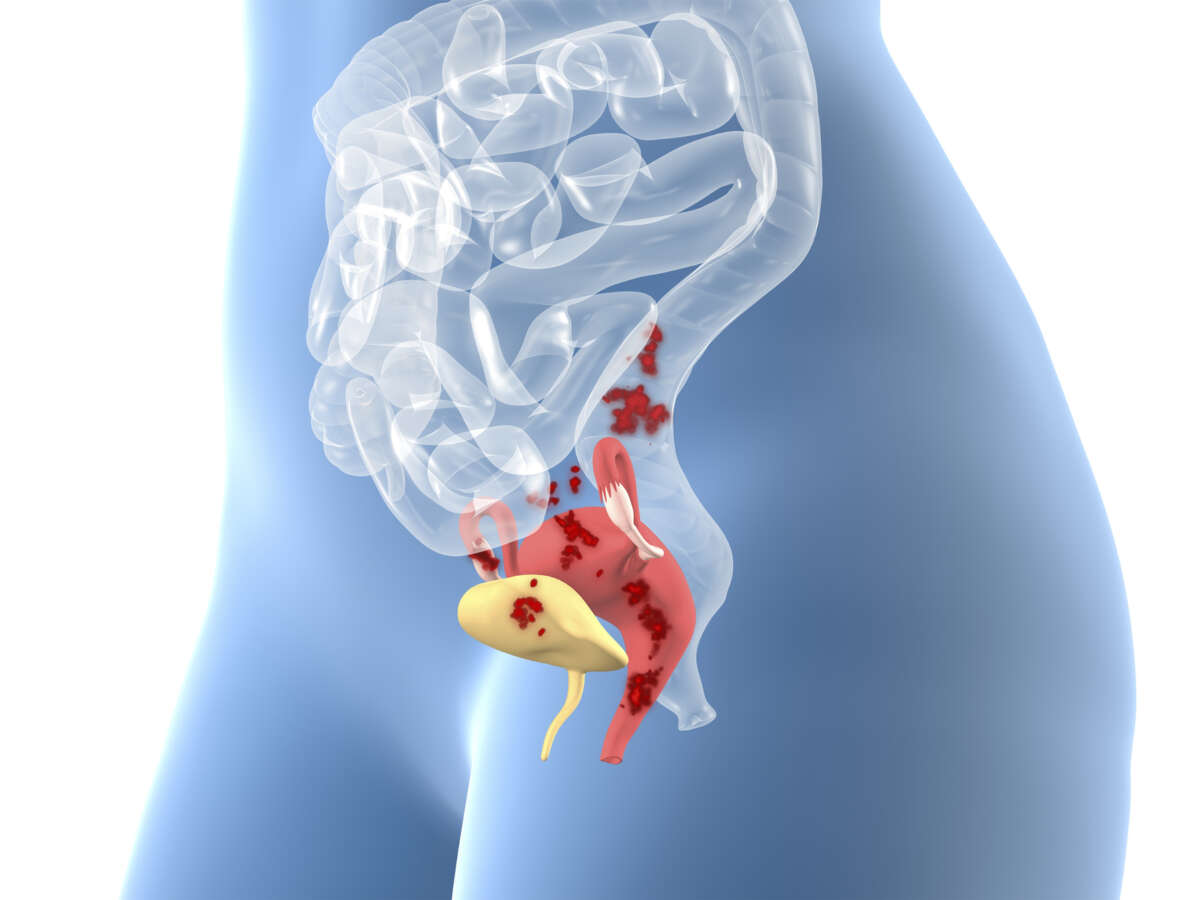 Бастауыш сыныптағы қыздармен жыныстық қатынас