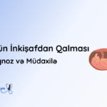 dolun inkisafdan qalmasi