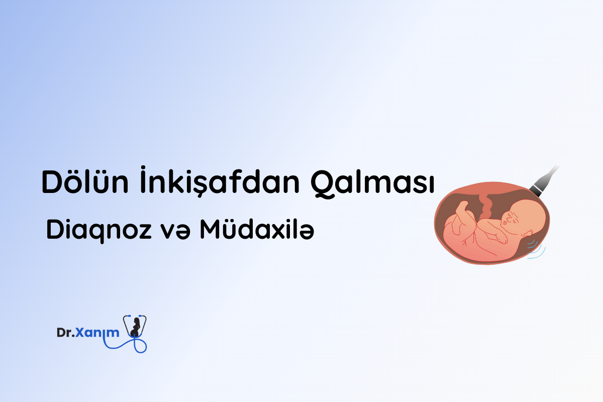 dolun inkisafdan qalmasi