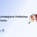 yumurtaliqlarin polikistoz sindromu