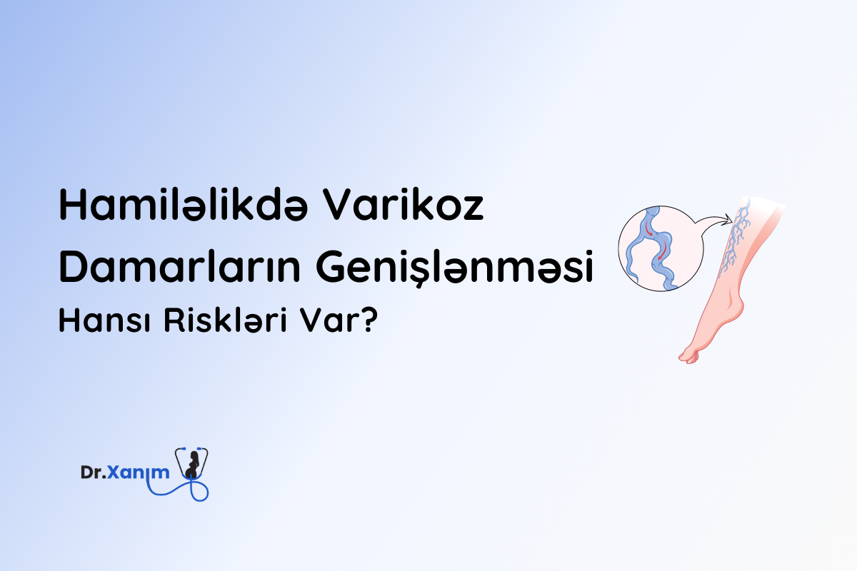 hamilelikde varikoz